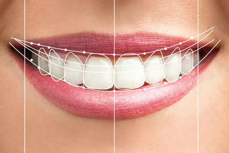Close-up of a smiling mouth with white teeth, pink lips. Overlay of symmetrical grid lines and geometric shapes analyze the smile for dental aesthetics.