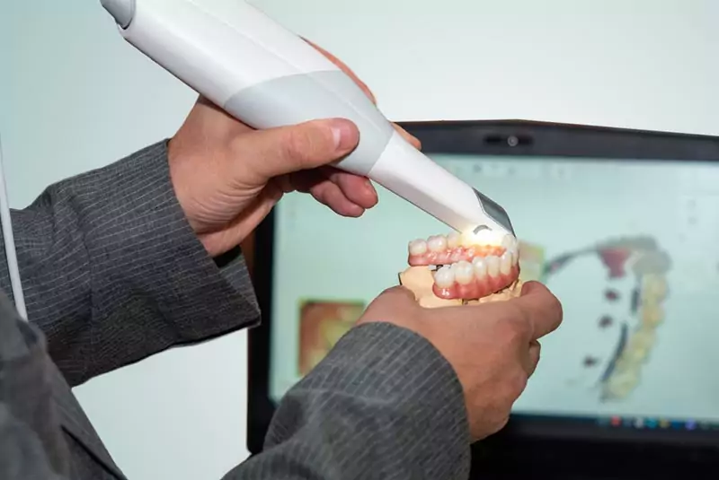 Hands holding a dental scanner over a model of teeth, capturing a digital impression. A computer screen in the background displays a 3D dental image.