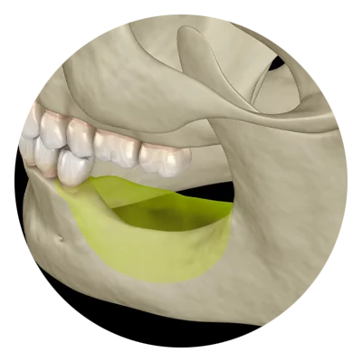 A digital illustration of a human jawbone, showcasing upper teeth and a highlighted lower jaw area in yellow against a black background.
